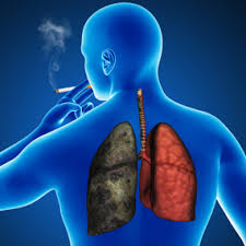chronic emphysema